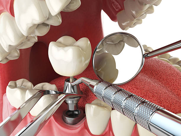Best Emergency Dental Services for Seniors in West Alexandria, OH